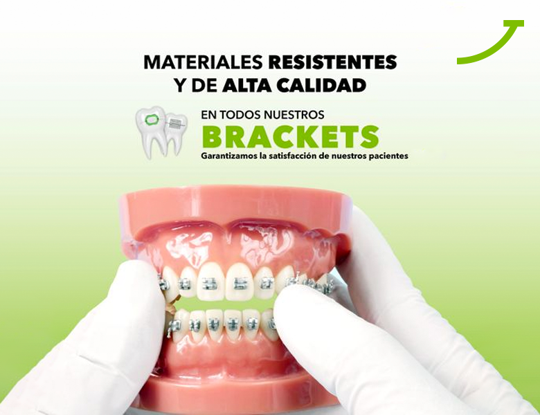 MX Brackets - Materiales de calidad MX Brackets - Materiales de calidad
