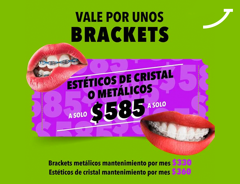 MX Brackets - Promociones MX Brackets - Promociones